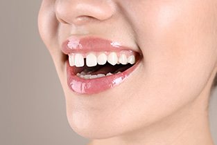 Close-up of woman’s smile with gap between the front teeth