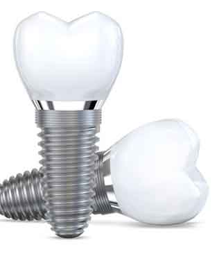 Two dental implants with crowns against white background